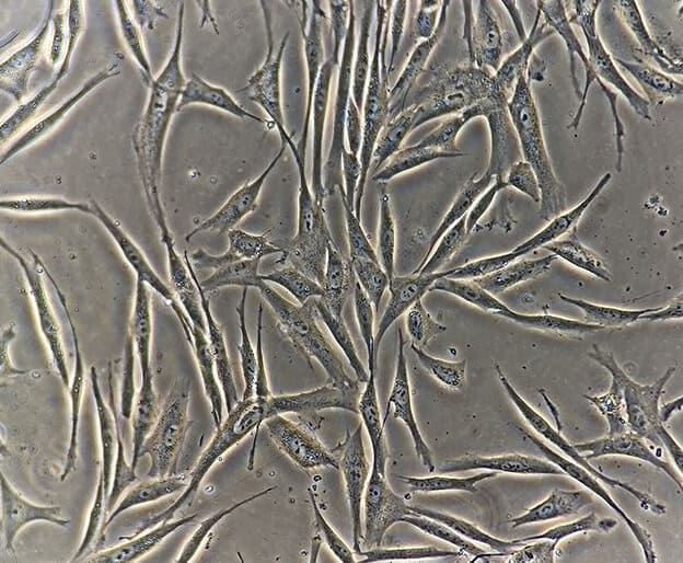 真皮線維芽細胞