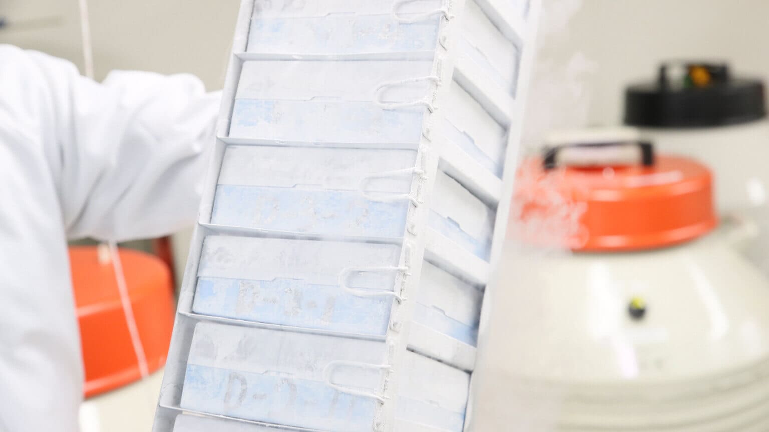 細胞保管セルバンク