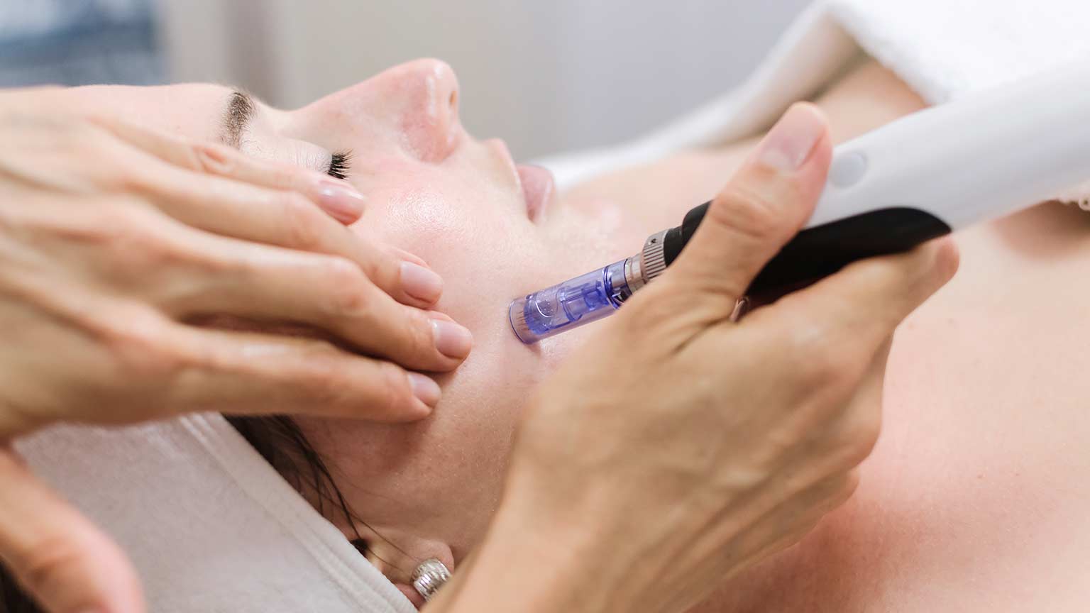 【2023年最新】ダーマペンは毛穴やニキビ跡に効果あり?リスクやデメリットは?