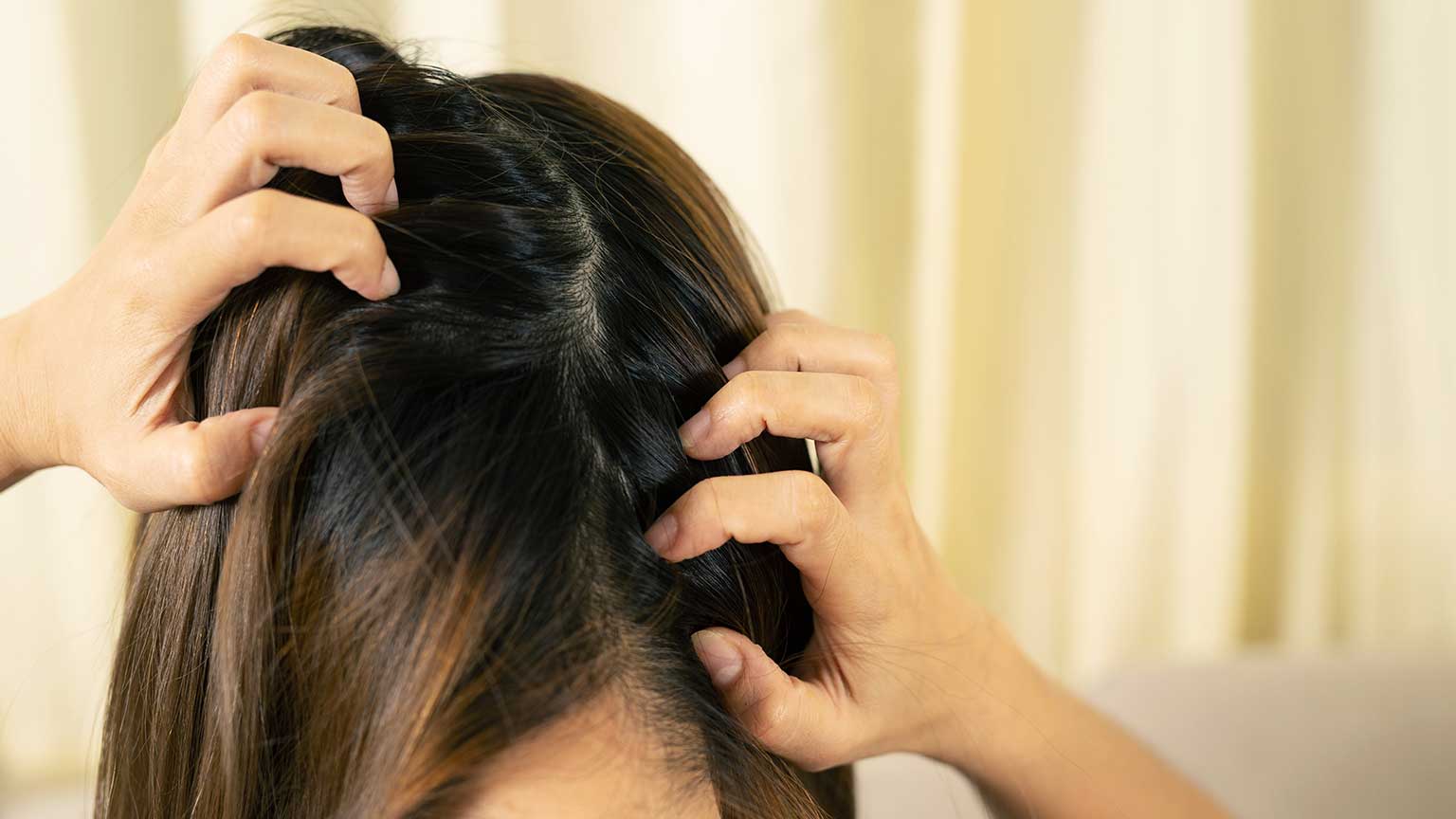 頭皮ケア(スカルプケア)について肌の専門医が徹底解説