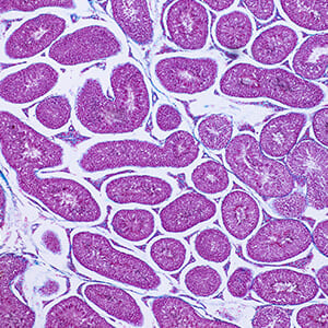 子宮由来幹細胞